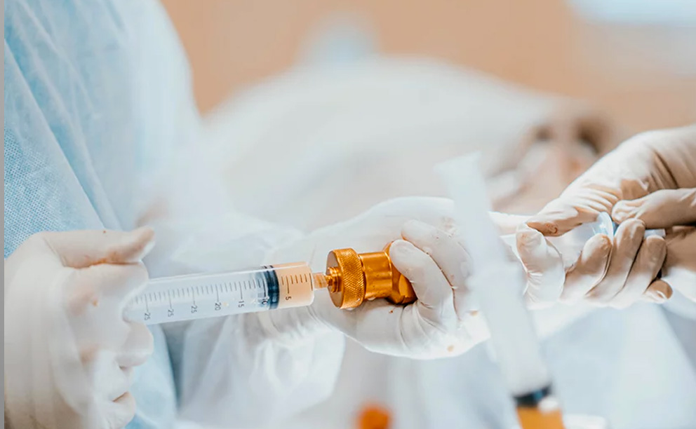 Le lipofilling pour des volumes naturels