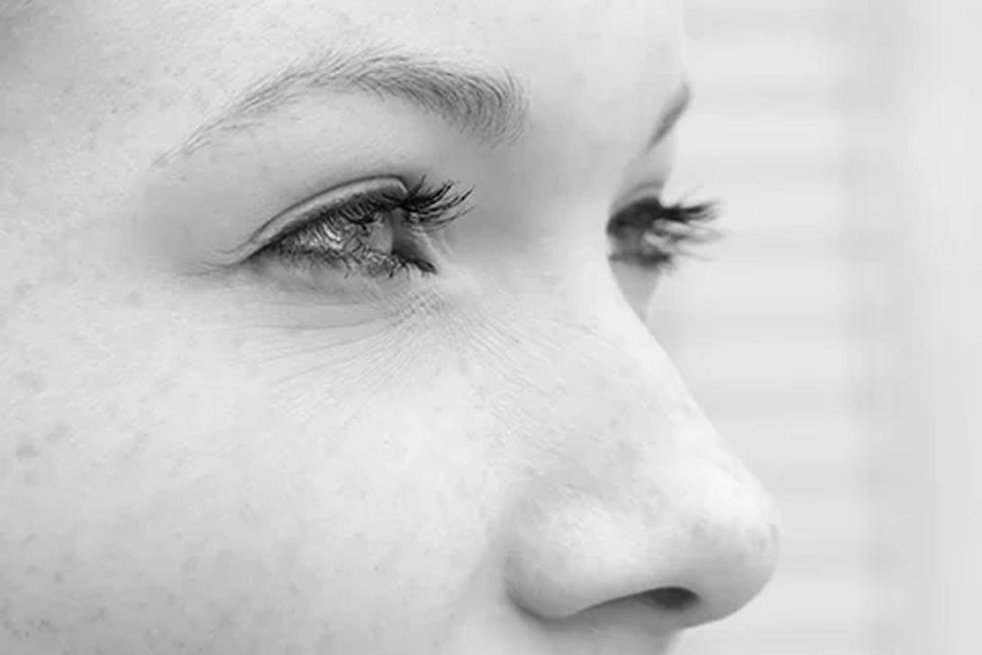 Rhinoplastie et bien-être mental