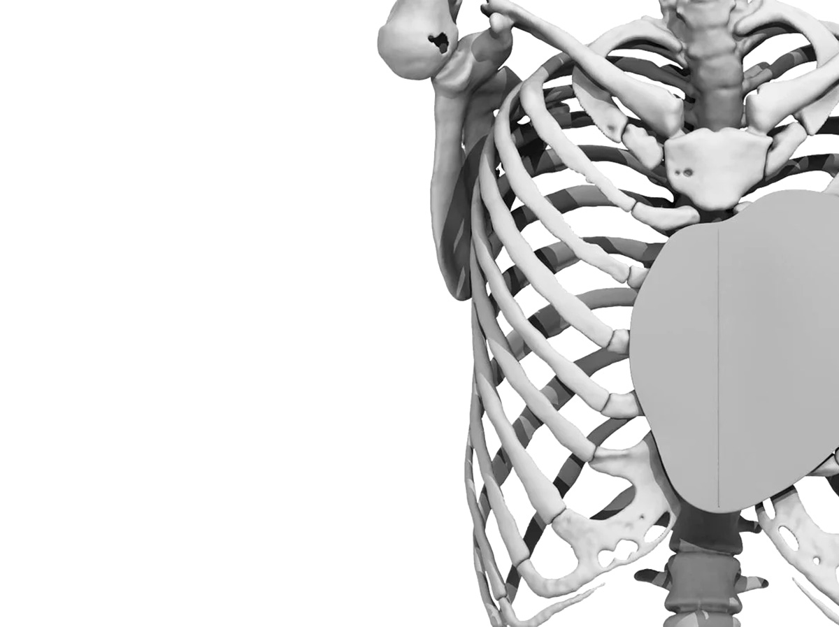 Prothèses sur mesure