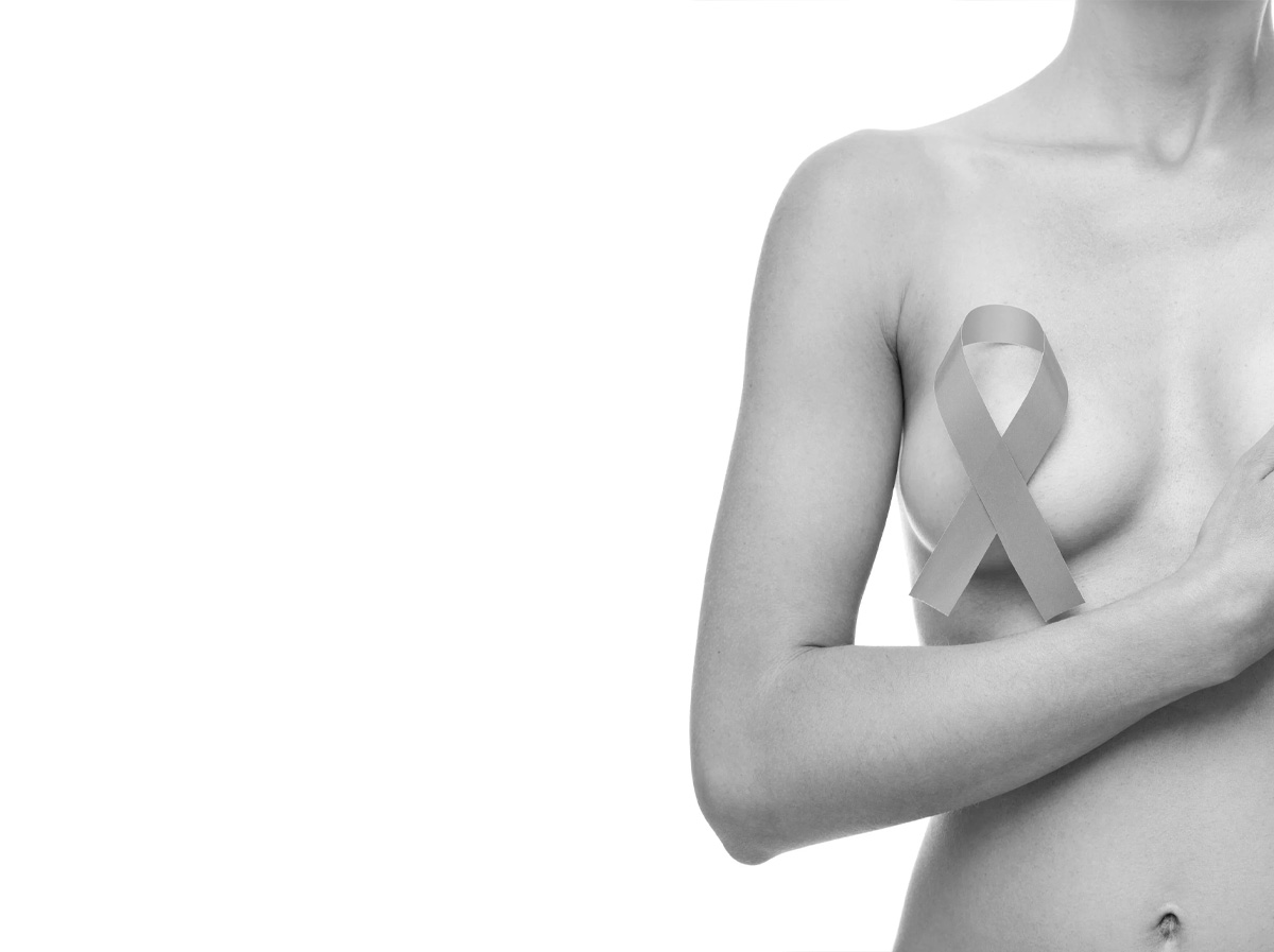 Reconstruction du sein par lambeaux