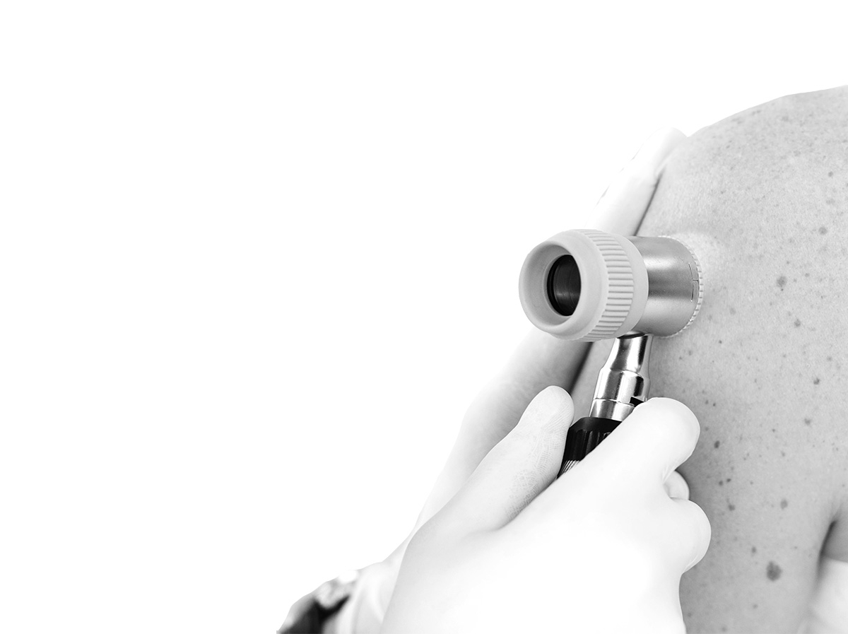 Chirurgie dermatologique