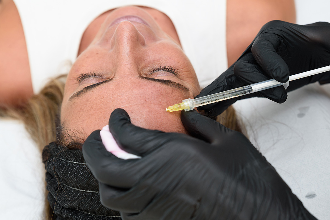 enlever les rides du front