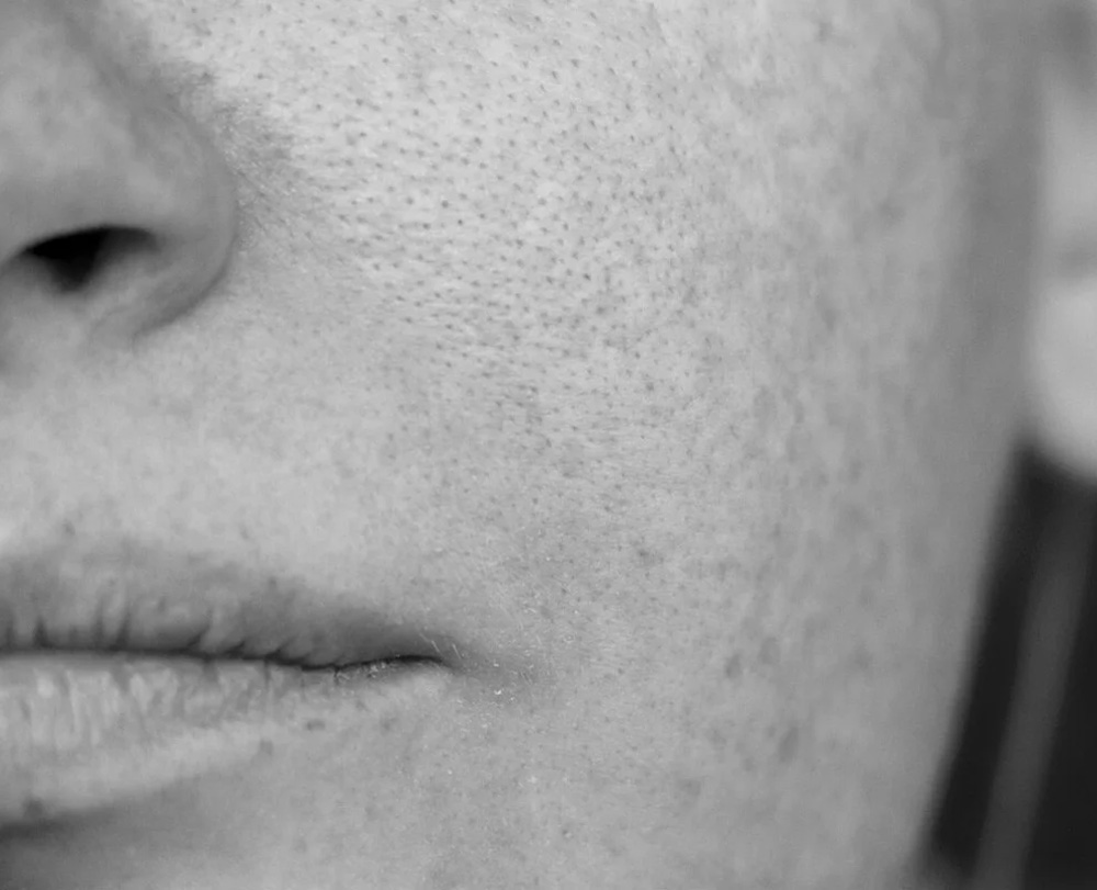 Dermatologie esthétique