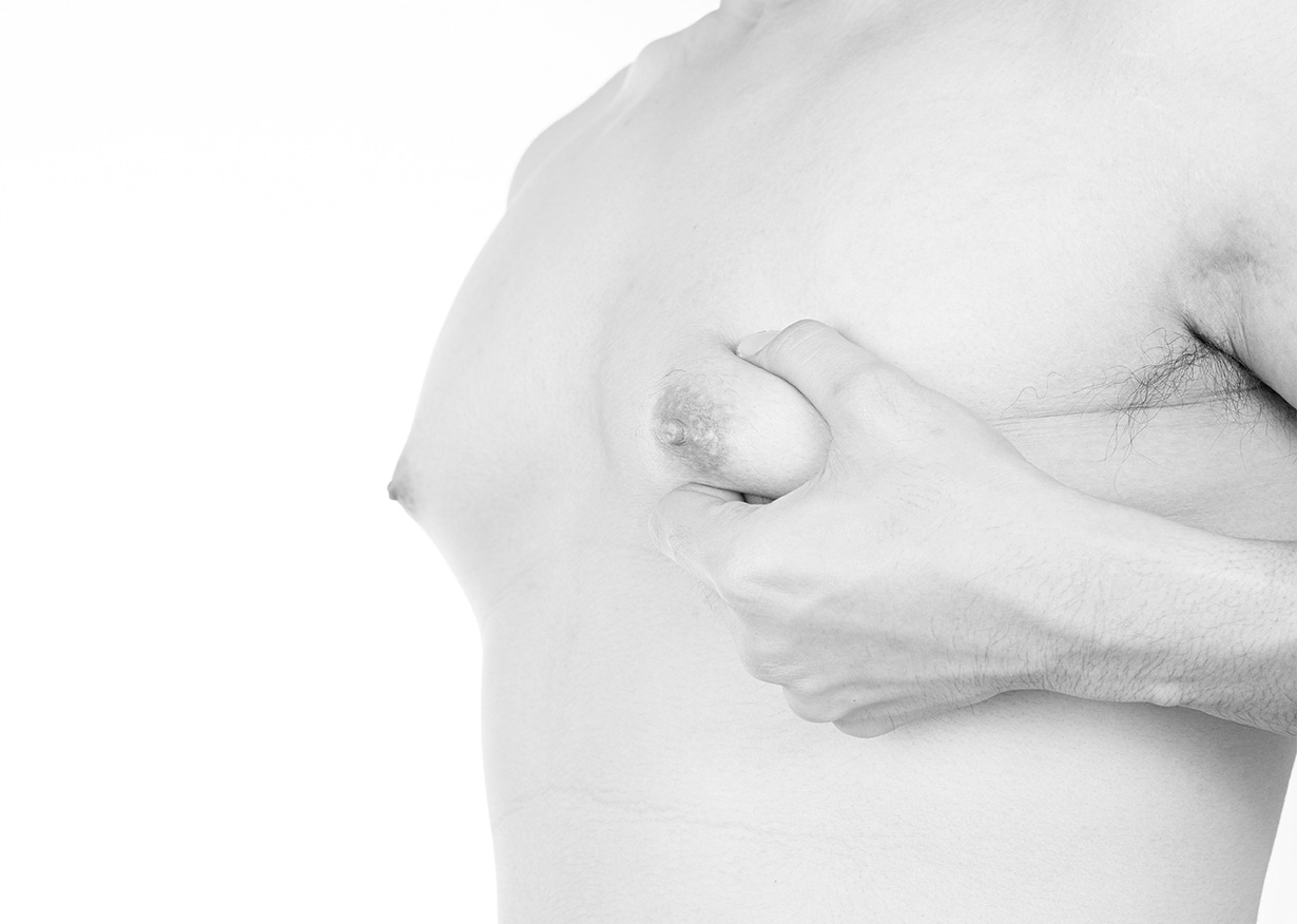 Gynécomastie