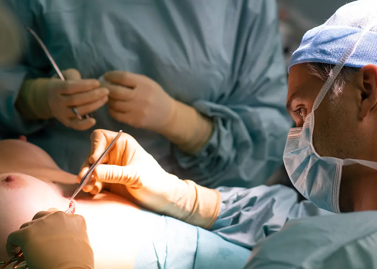 Lifting sein mastopexie