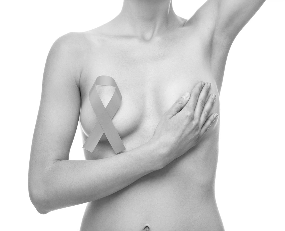 Symétrisation du sein controlatéral après cancer du sein